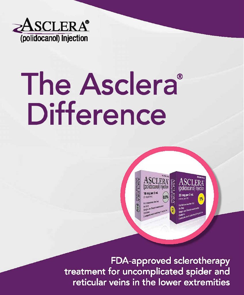 asclera sclerotherapy